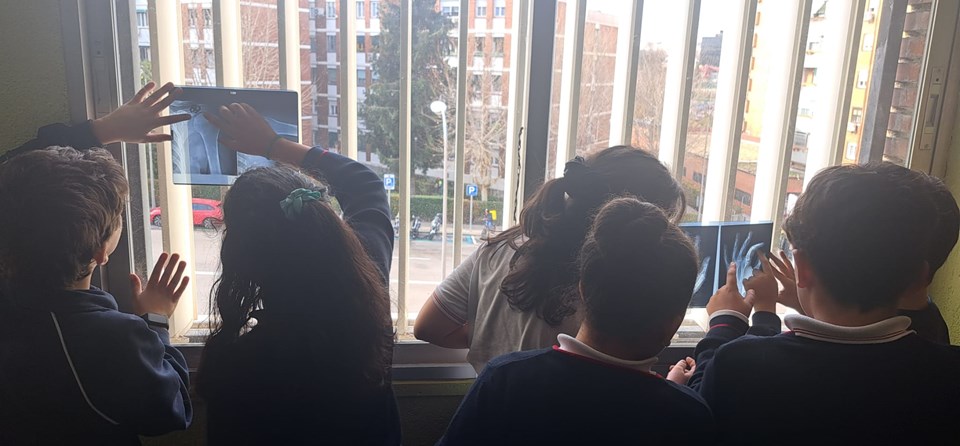 "INFORME RADIOLÓGICO" (5º PRIMARIA)